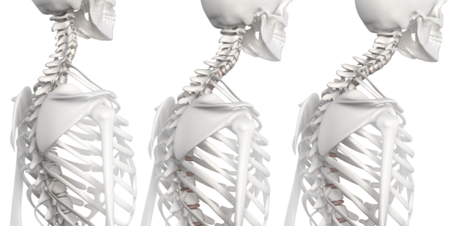 Imagem interna da coluna vertebral