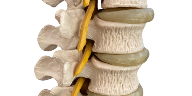 Imagem da coluna vertebral e hérnia de disco